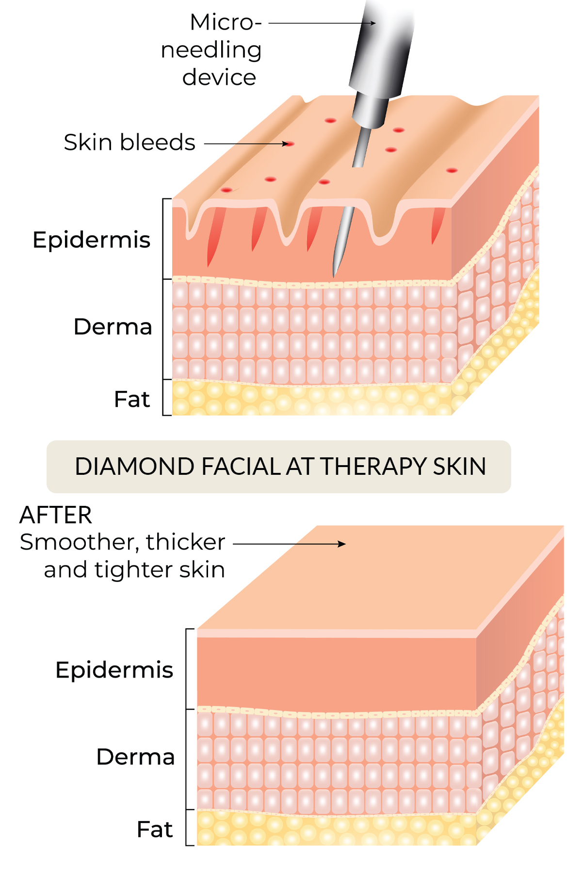 DIAMOND FACIAL AT THERAPY SKIN ILLUSTRATION